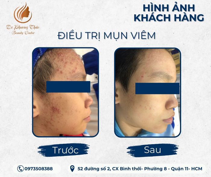 Ảnh 1 tại Dr.PhuongThao Beauty Center