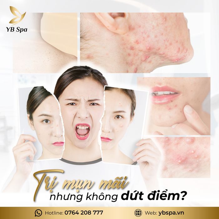 YB Spa hình ảnh 1