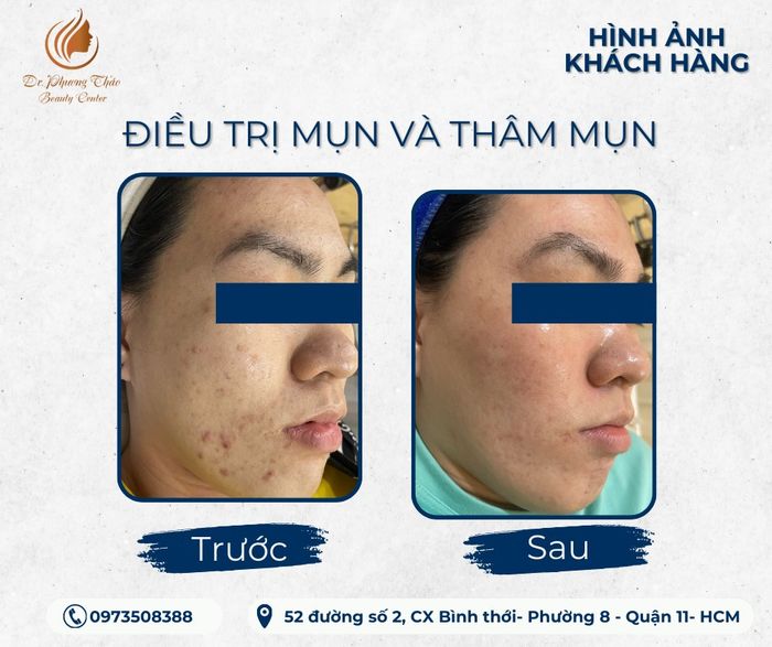Ảnh 2 tại Dr.PhuongThao Beauty Center