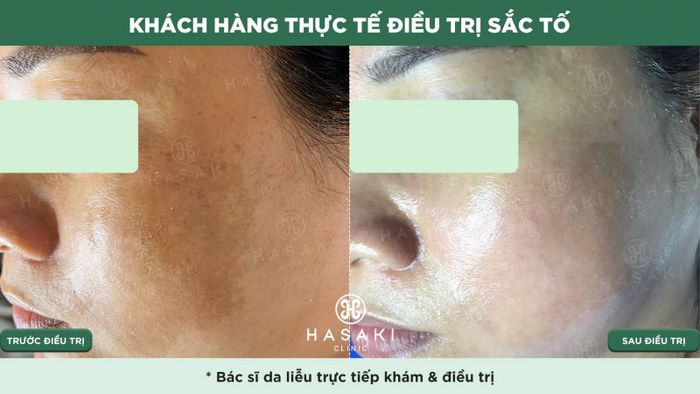 Hình ảnh 2 của <i>Hasaki Beauty & Clinic</i>