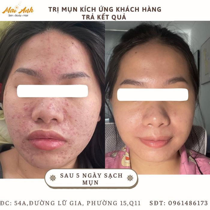 Ảnh 2 của Mai Anh Spa