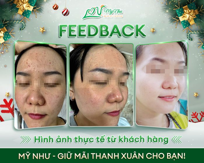 Hình ảnh 2 tại Mỹ Như Beauty Center & Spa