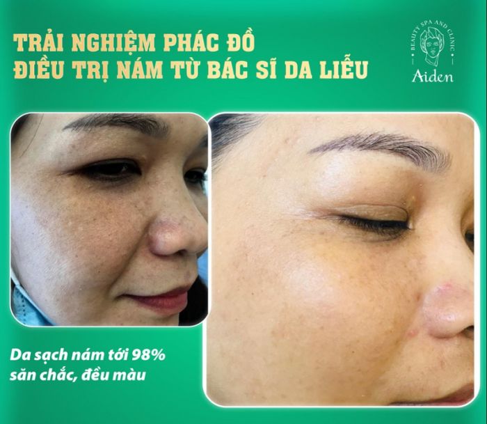 Hình ảnh Aiden Beauty Spa & Clinic số 1