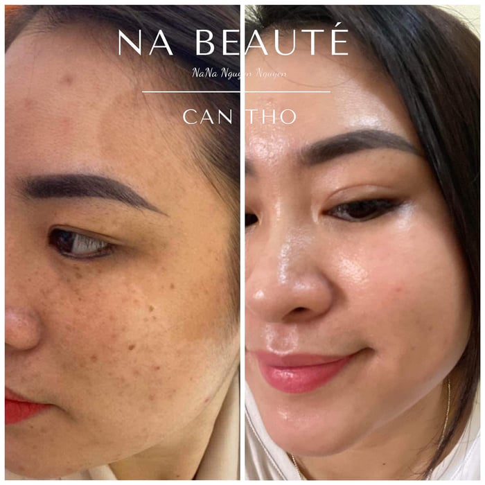 Hình ảnh đầu tiên của Na Beauty Spa