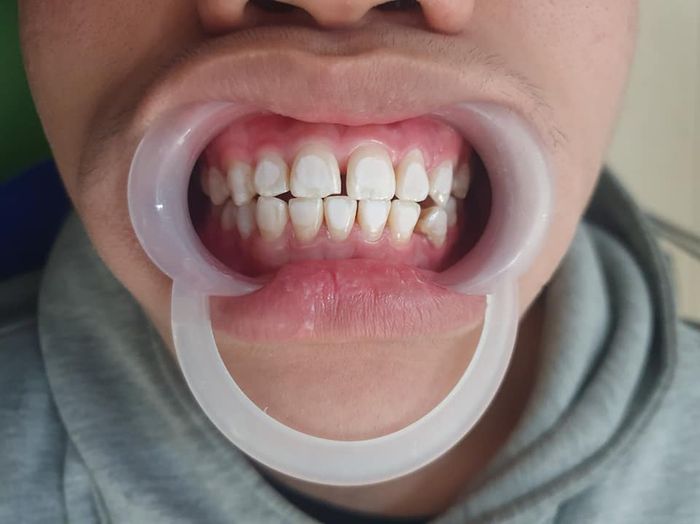 Hình ảnh Nha Khoa Quốc Tế For Smile 2