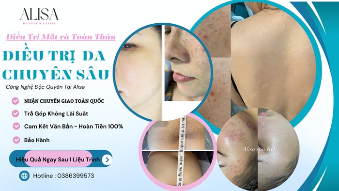 Hình ảnh ALISA Spa Biên Hòa 1