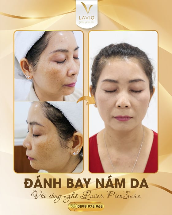 Hình ảnh thứ 2 của LAVIO Spa & Clinic Cần Thơ