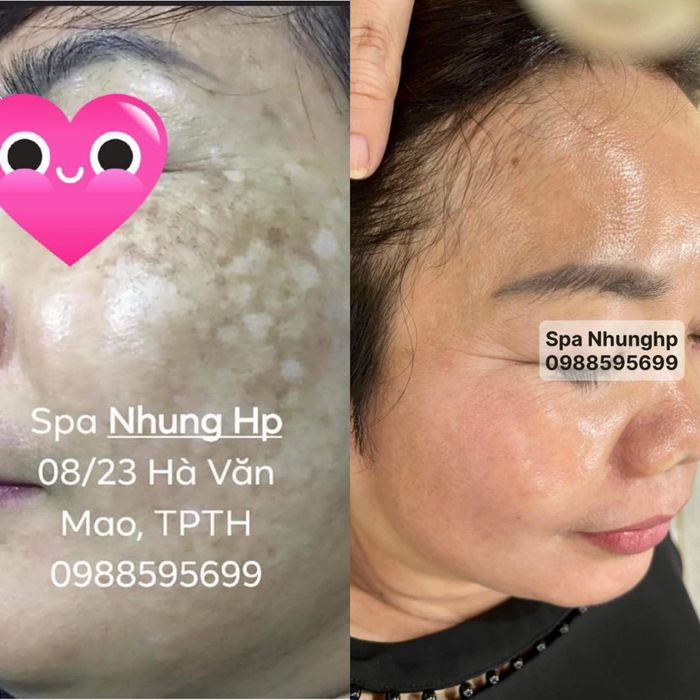 Hình ảnh Spa Nhung HP 1