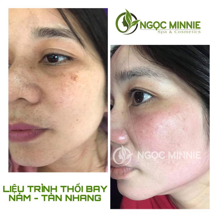 Hình ảnh thứ hai của Ngọc Minnie Spa