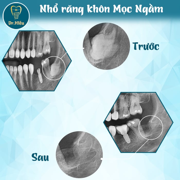 Ảnh 2 của Nha Khoa BS.Hiếu Bình Dương