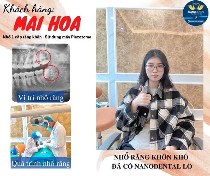 Hình ảnh Nha khoa NanoDental 2