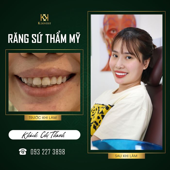 Nha khoa Quốc tế K Dentist - Quảng Ngãi hình ảnh 1