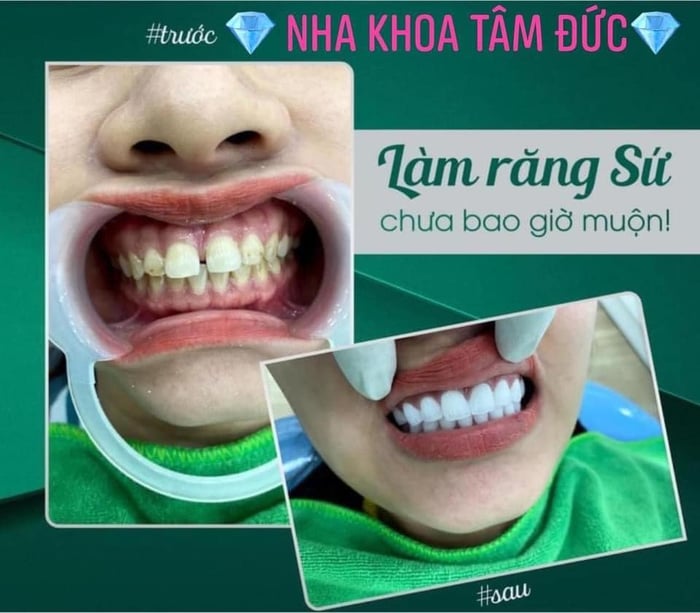 Hình ảnh Nha Khoa Tâm Đức 2