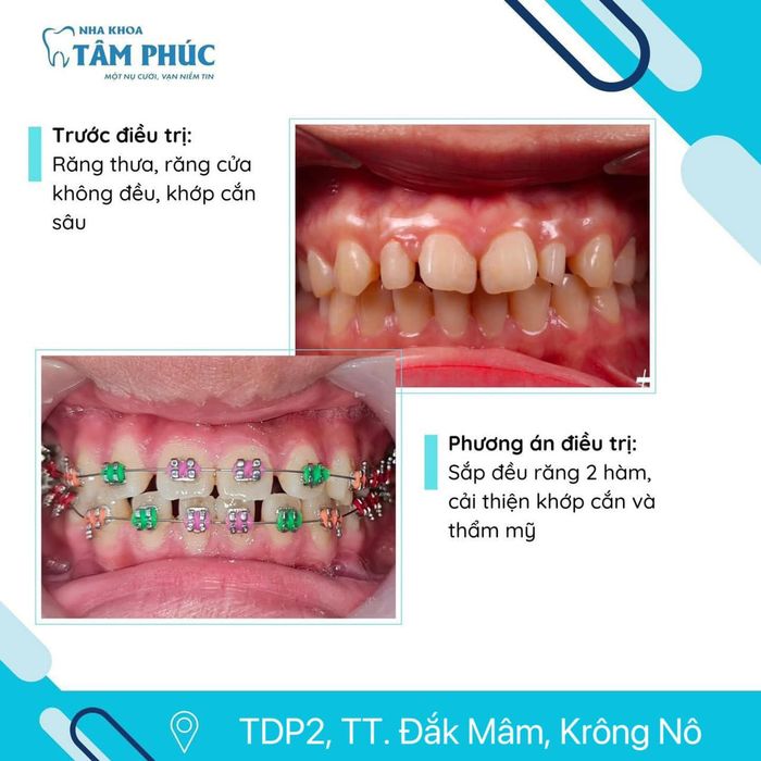 Ảnh Nha khoa Tâm Phúc Krông Nô