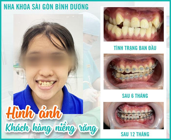 Ảnh 1 Nha Khoa Daknong - Nha Khoa Sài Gòn 9