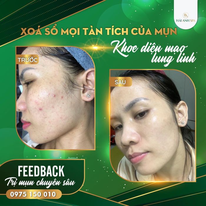 Spa Hải Anh hình ảnh 1