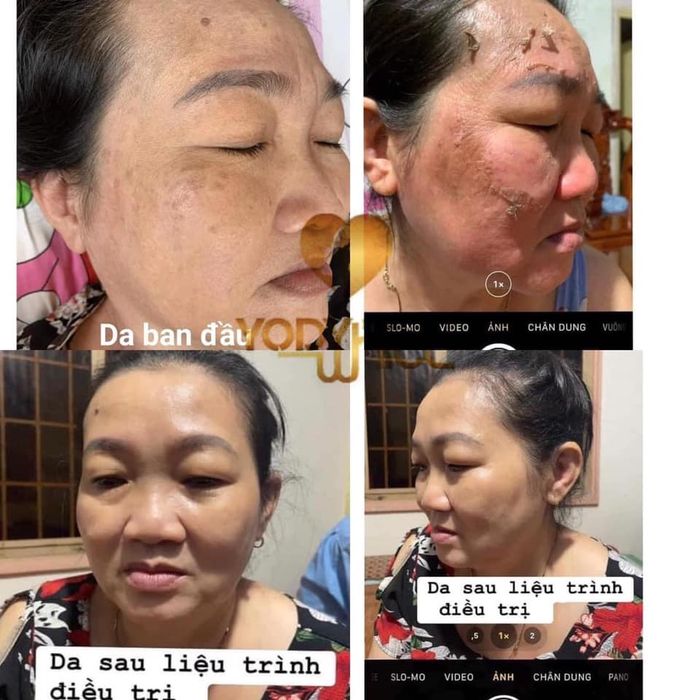 Ảnh của HP Beauty Spa