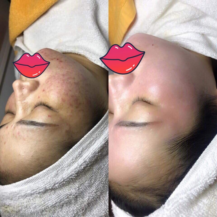 Hình ảnh Mimoza Spa 2