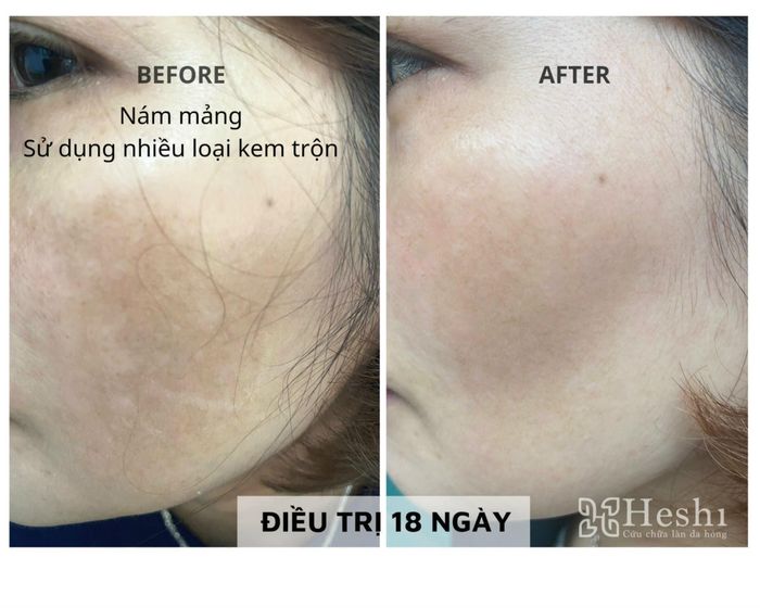 Hình ảnh của Trung tâm Trang Beauty 1