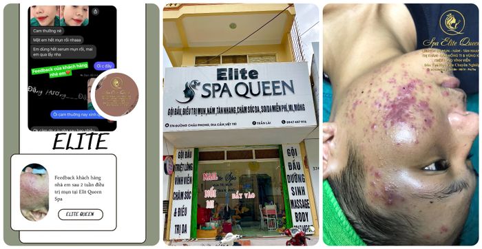 Hình ảnh Spa Queen 2