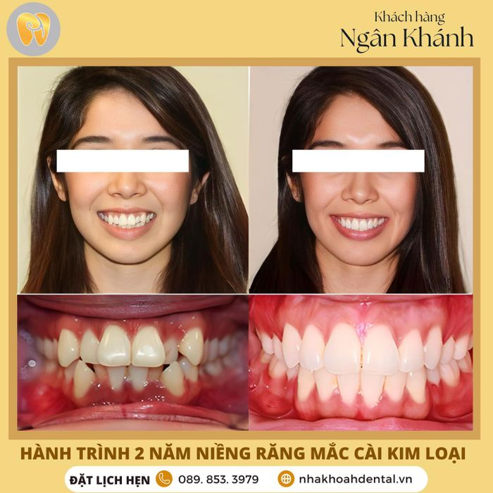 Nha Khoa H Dental hình ảnh 2