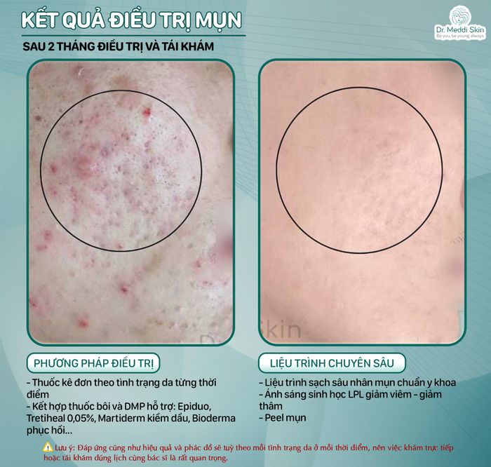 Hình ảnh Meddi Skin 1