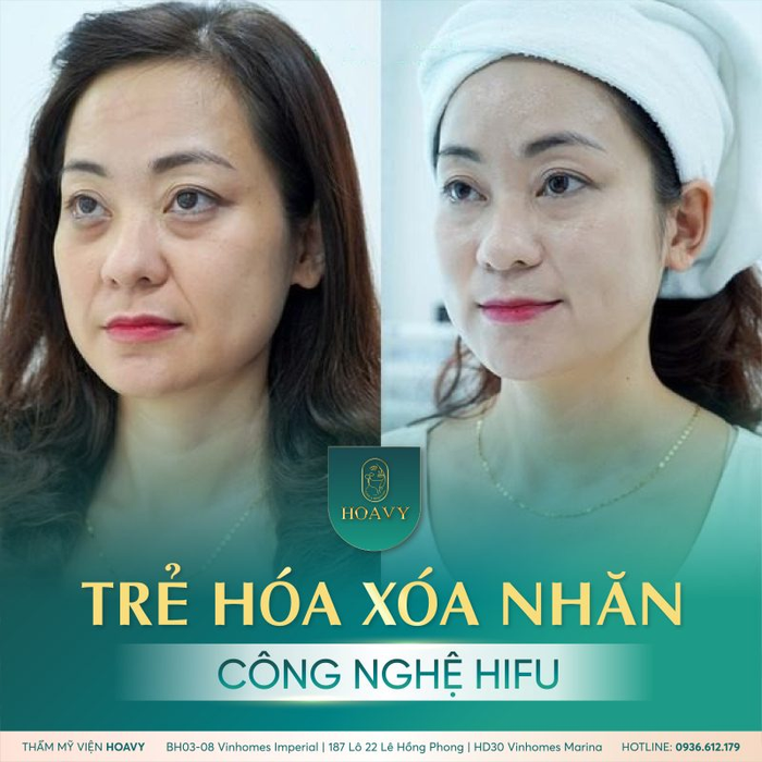 Hình ảnh của Thẩm mỹ viện HoaVy 2