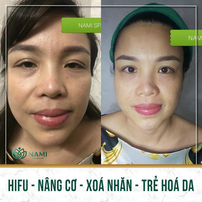 Hình ảnh Nami Spa Beauty & Clinic 1