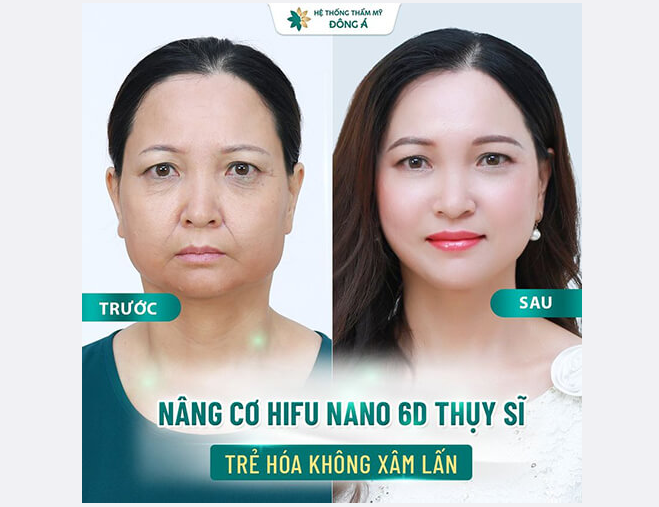 Hình ảnh Bệnh viện thẩm mỹ Đông Á số 1