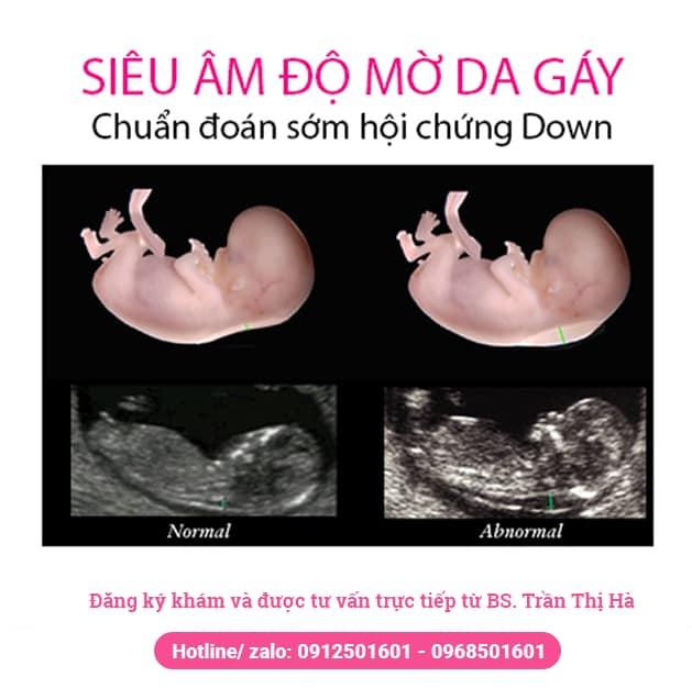 Hình ảnh 3 của Phòng khám BS Trần Thị Hà