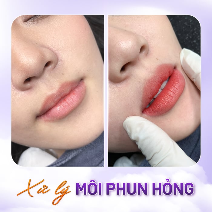 Hình ảnh Thẩm Mỹ Quốc Tế Linh Anh - Gò Vấp 2