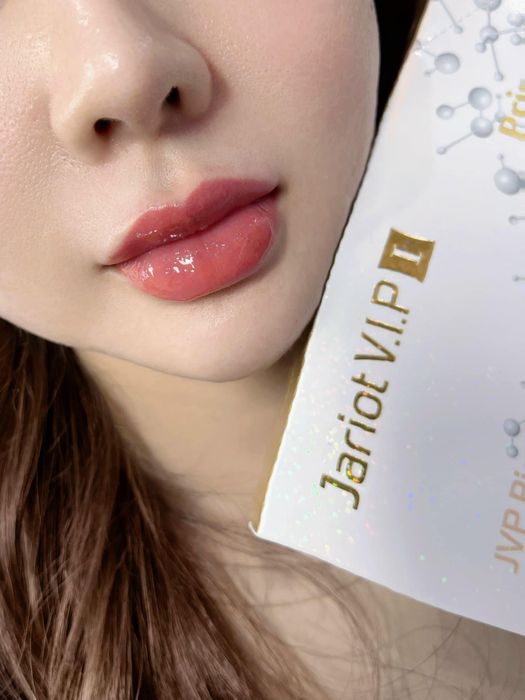 Hình ảnh Filler Jariot Vip 1