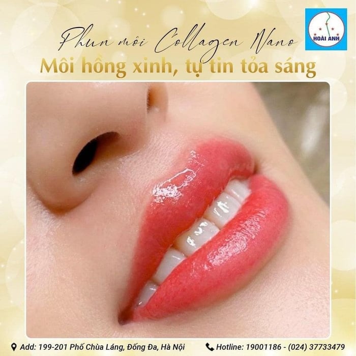 Ảnh 2 - Thẩm Mỹ Viện Hoài Anh