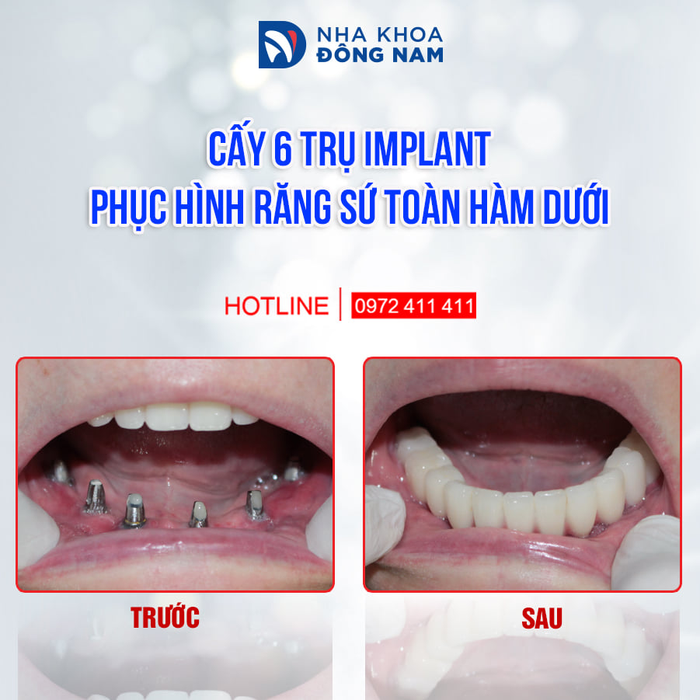 Hình ảnh Nha khoa Đông Nam 1