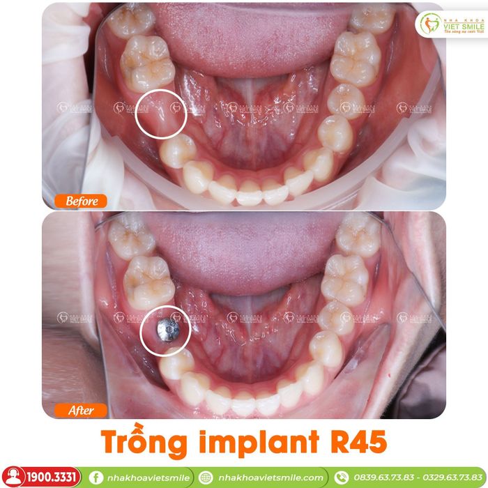 Hình ảnh 1 của Nha khoa Việt Smile