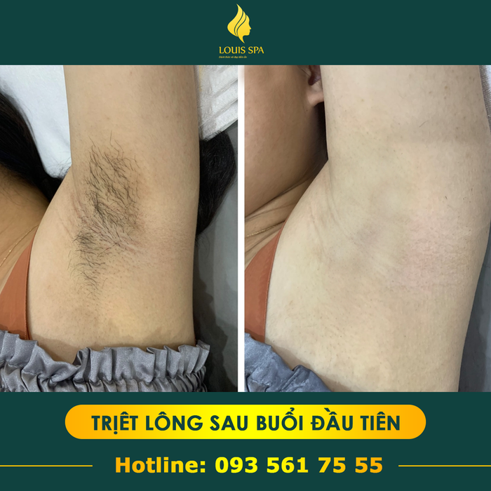 Hình ảnh Louis spa 2