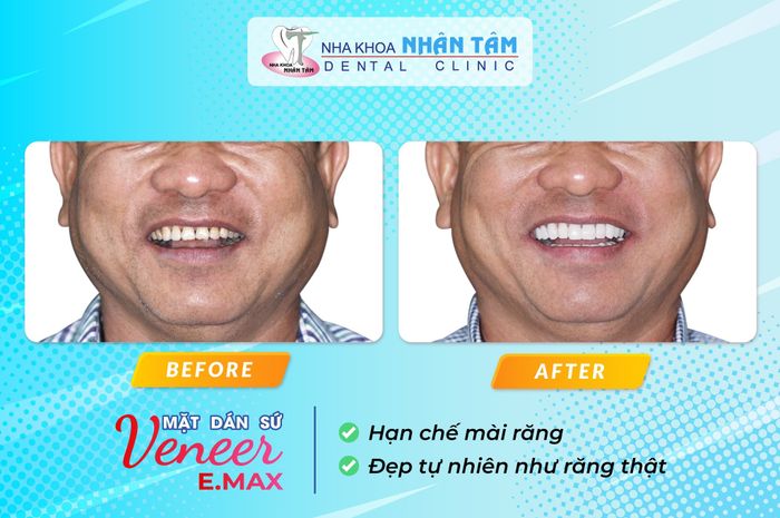 Nha khoa Nhân Tâm – Dental Clinic – Hình ảnh 2