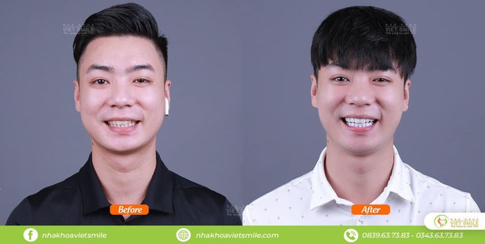 Nha Khoa VIET SMILE – Hình ảnh 1