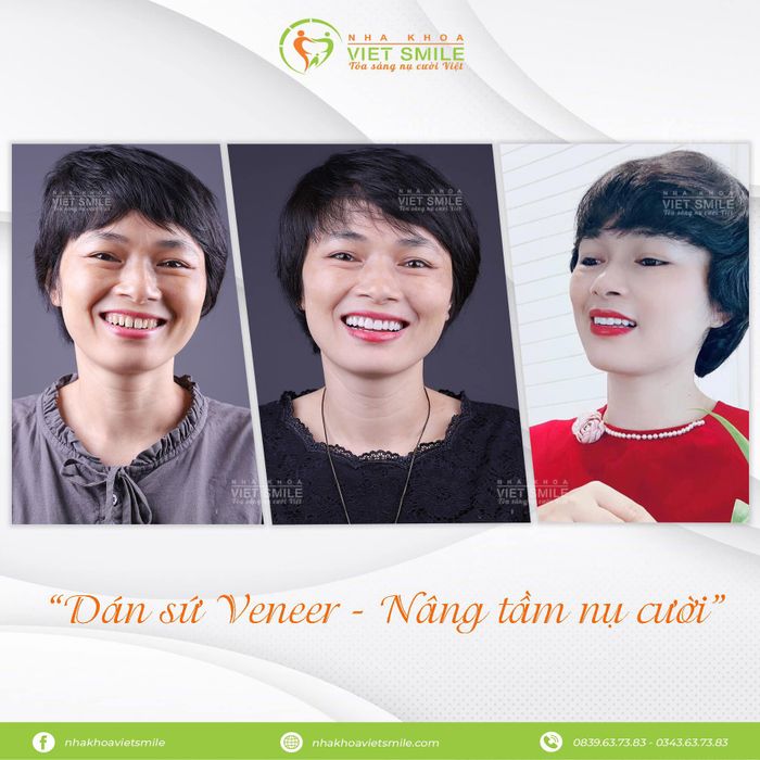 Nha Khoa VIET SMILE – Hình ảnh 2