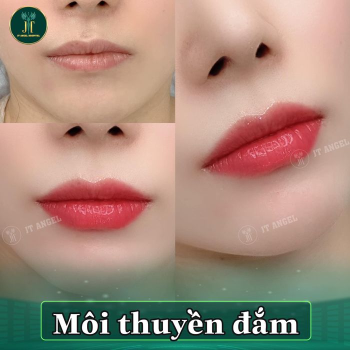 Bệnh viện Thẩm mỹ JT Angel ảnh 1