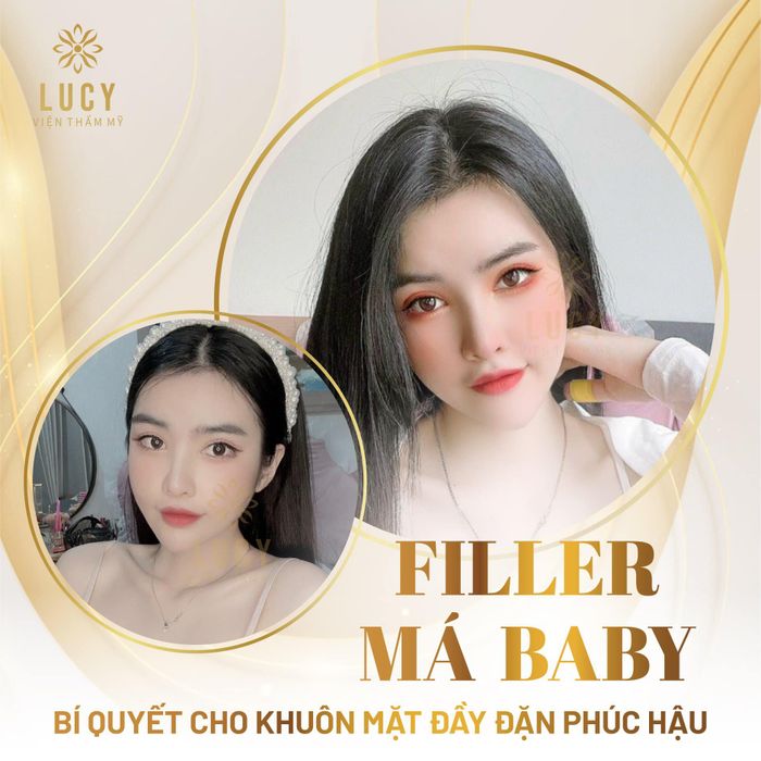 Ảnh 2 tại Trung tâm Thẩm Mỹ Lucy