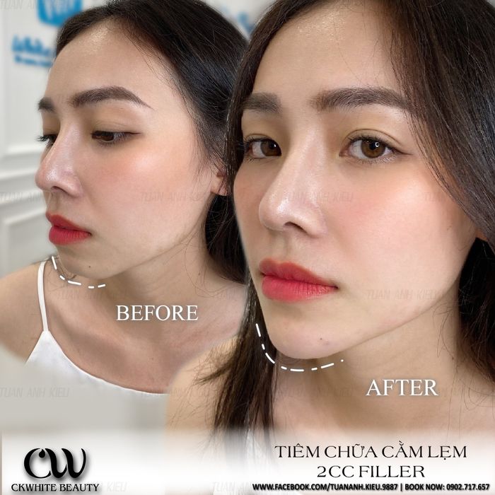 Ảnh 2 tại Trung tâm Thẩm Mỹ CKWhite Beauty