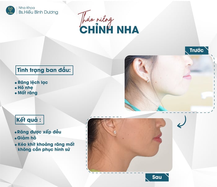 Hình ảnh 1 tại Nha Khoa BS. Hiếu Bình Dương