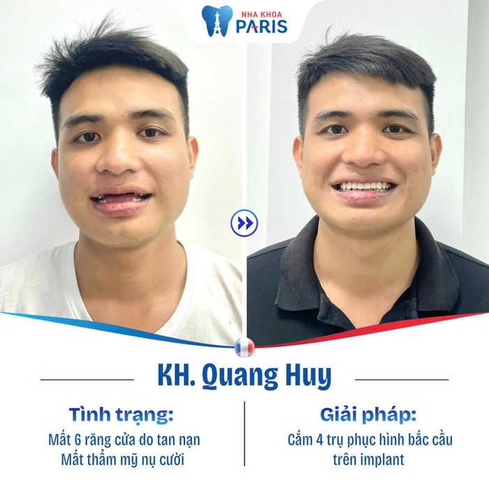 Ảnh 2 của Nha khoa Paris Bình Dương