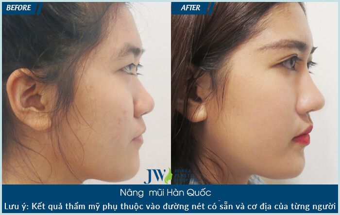 Hình ảnh Bệnh viện JW Hàn Quốc 2