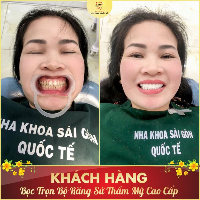 Hình ảnh Nha Khoa Sài Gòn Quốc Tế 2