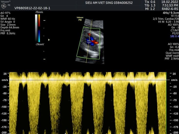 Phòng khám sản phụ khoa - Siêu âm 5D Việt Sing Dĩ An - Hình ảnh 3