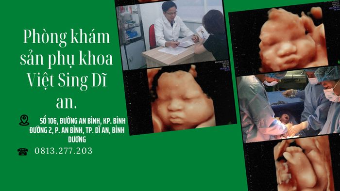 Phòng khám sản phụ khoa - Siêu âm 5D Việt Sing Dĩ An - Hình ảnh 2