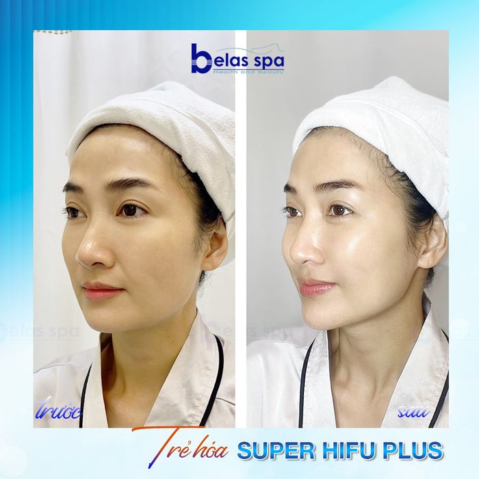 Hình ảnh 1 của Belas Health & Beauty