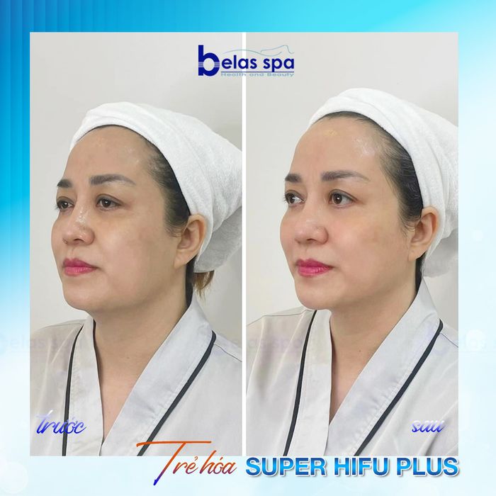 Hình ảnh 2 của Belas Health & Beauty